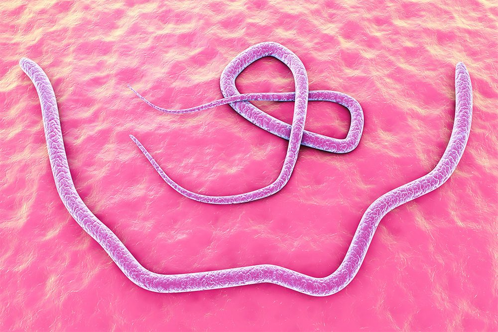 Your un-gross guide to parasites (and how to avoid them)